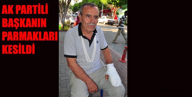 AK PARTİLİ YÖNETİCİNİN PARMAĞI KOPTU