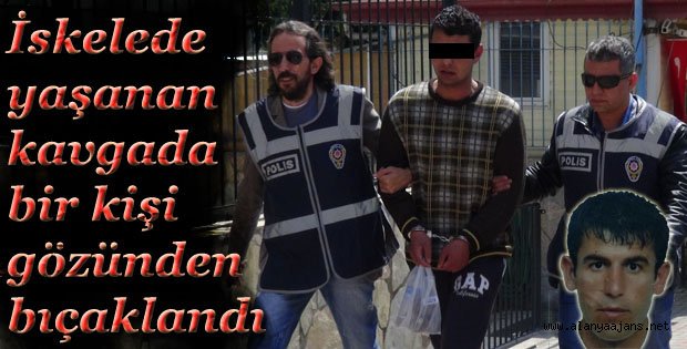 KAVGADA GÖZÜNDEN BIÇAKLANDI